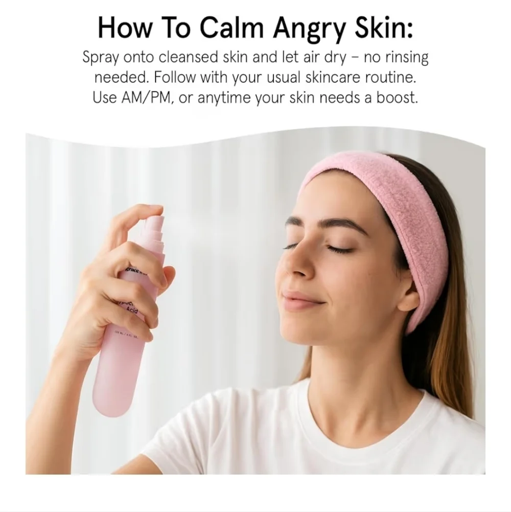 Face Acne Spray